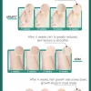 Hair Removal Device - Image 9